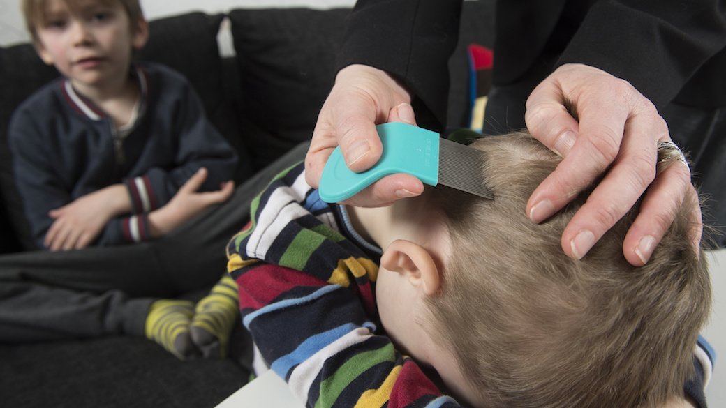 5 Best Lice Kits July 2020 BestReviews